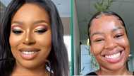 Woman plugs SA with products to clear dark spots in a video, Mzansi is impressed