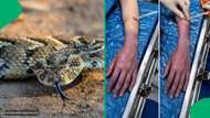 "Very good information": Snake expert debunks dangerous first-aid myth with scary snakebite photo