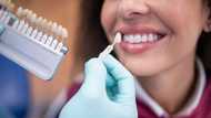 What is the cost of veneers in South Africa? All you need to know