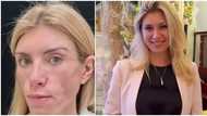 Russian beauty queen unable to close her eyes and smile again after undergoing plastic surgery to look young