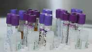 Deal reached for generic drug to prevent HIV infection