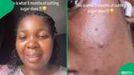 Woman reveals stunning skin transformation after cutting sugar for 5 months
