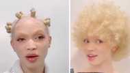 Alexis Carey gets Lizzo's attention, Albino model goes viral for rocking blonde afro hairstyle