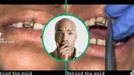 Dentist's video of gold tooth removal clocks 920K views and leaves SA TikTok users stunned