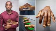 Artist creates realistic artificial limbs for dark skin, photos blow people away