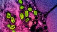 Monkeypox to be renamed mpox: WHO