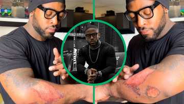 Prince Kaybee has fans concerned after sharing pictures of his 4th motorbike crash injuries
