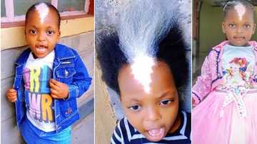 Little girl with unique shiny birthmark & white frontal hair breaks internet, goes viral: "She is so precious"