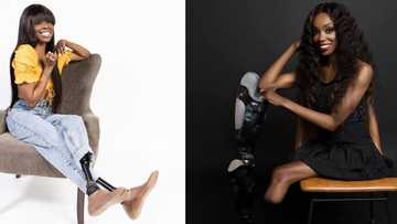 Gorgeous woman who lost legs and fingers after falling sick becomes a model