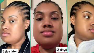 Lady goes through surgery to reduce her jaw size, TikTok video of recovery gets 5.4 million views