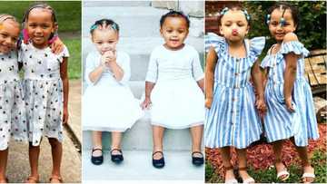 Kalani and Jarani: 5 photos of the twin sisters born with rare black and white skin colours