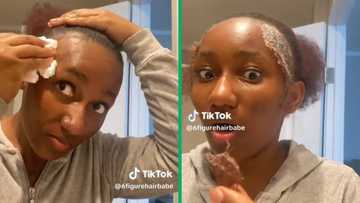 Woman loses edges after perm disaster, TikTok of hair mishap gets 10 million views