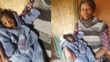 Mother feels devastated after giving birth to an infant with Progeria, a rapid ageing condition