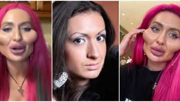 Haibo: Lady spends R32.8k on cheek fillers to have the 'biggest cheeks'