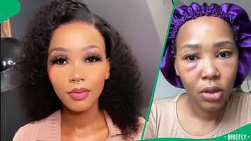 "Sorry, mama": Woman fumes after face reacts to online skincare products, SA astonished