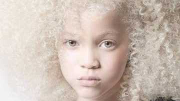 Beautiful girl with albinism has Mzansi mesmerised: "She's a gem"