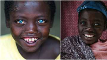 Abushe: The boy, 14, with adorable natural blue eyes everyone is talking about