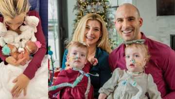 Conjoined twins separated after 10 hour surgery, parents grateful to doctors