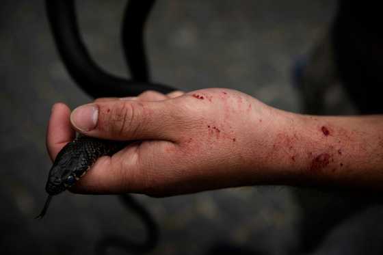 2 KZN Kids Bitten by Venomous Snake Without Antivenom Available Leave ...
