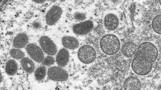 Why monkeypox may soon get a new name