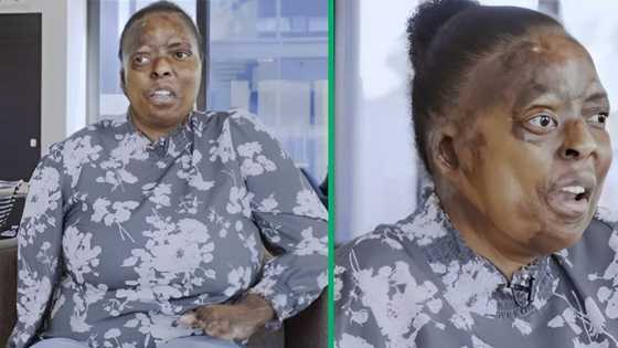 Brave survivor's journey: Itumeleng Sekhu-Ped's inspiring story Touches hearts in Mzansi