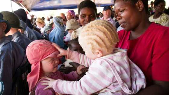 Mozambique arrests father planning to sell albino children