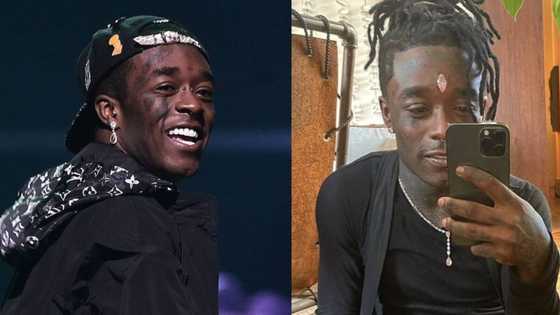 Lil Uzi Vert’s R359m diamond ripped out his forehead during performance