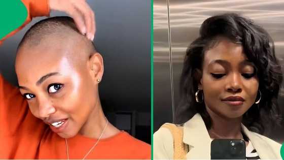 From bald beauty to blessed: Woman shares hair growth serums she used