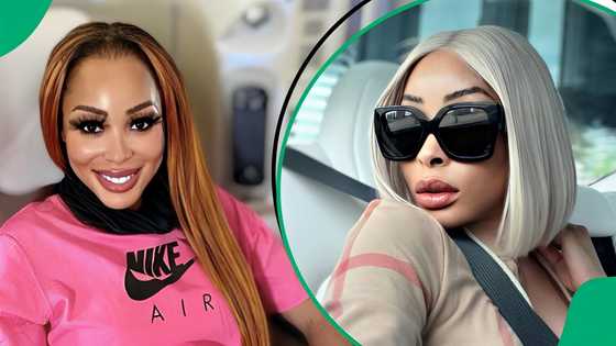 Khanyi Mbau shares close-up picture of her face 100 days post-surgery, fans react: "She's beautiful"