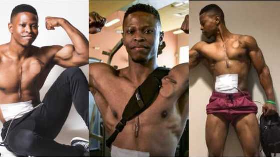 Andrew Jones: Meet the fitness model who walked with an artificial heart in his backpack for over 2 years