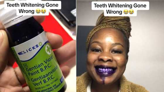Woman whitens teeth with a violet antiseptic dye, dentist advises Mzansi after it all goes wrong in TikTok