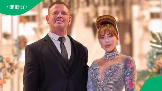 Jojo Robinson slammed over husband Calven's "botched" facelift: "It was Jojo's idea"