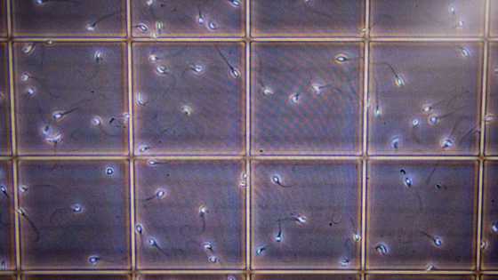 Sperm count is declining at accelerating rate worldwide: study