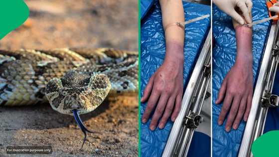 "Very good information": Snake expert debunks dangerous first-aid myth with scary snakebite photo