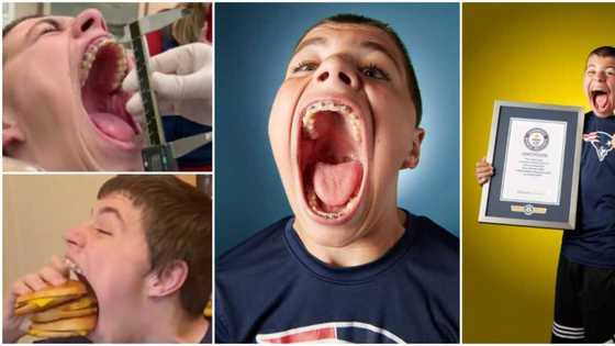 Teen breaks Guinness record for widest mouth that takes an apple, can and baseball at once