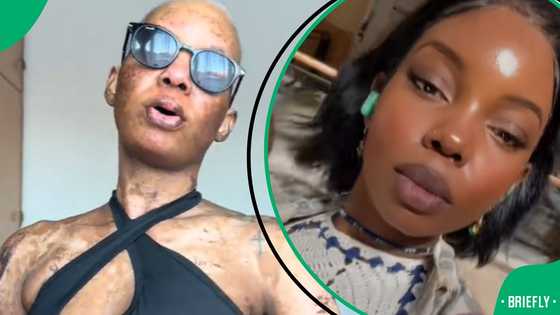 “I had less than 5% chances of surviving”: Woman shares story of being in coma for over 6 weeks