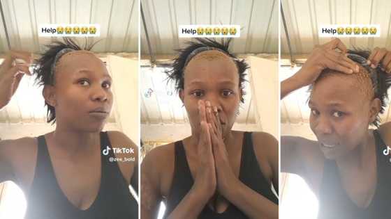 Woman painfully removes wig glued on her head, video showing bald patches on scalp goes viral