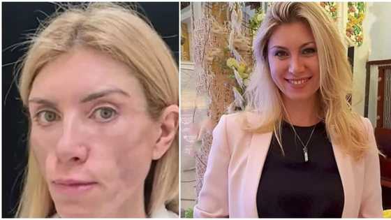 Russian beauty queen unable to close her eyes and smile again after undergoing plastic surgery to look young