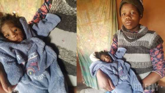 Mother feels devastated after giving birth to an infant with Progeria, a rapid ageing condition