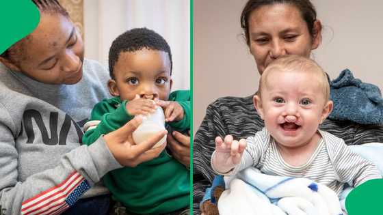 "Every child deserves to smile": Free cleft surgery programme opens for children in Gauteng this May