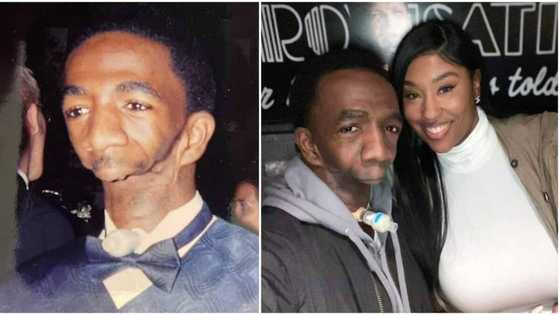 Joseph Williams: Man born without jaw marries beautiful lady after giving up on finding true love