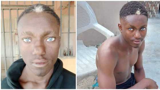 Young Nigerian man with natural light blue eyes and white hairs in front of his head goes viral, wows many