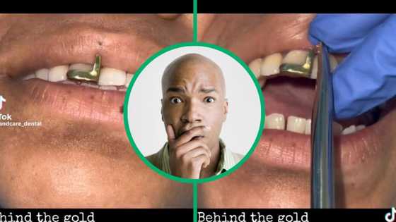 Dentist's video of gold tooth removal clocks 920K views and leaves SA TikTok users stunned