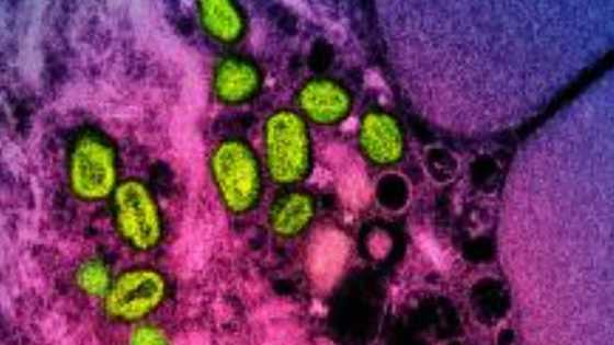 Monkeypox to be renamed mpox: WHO